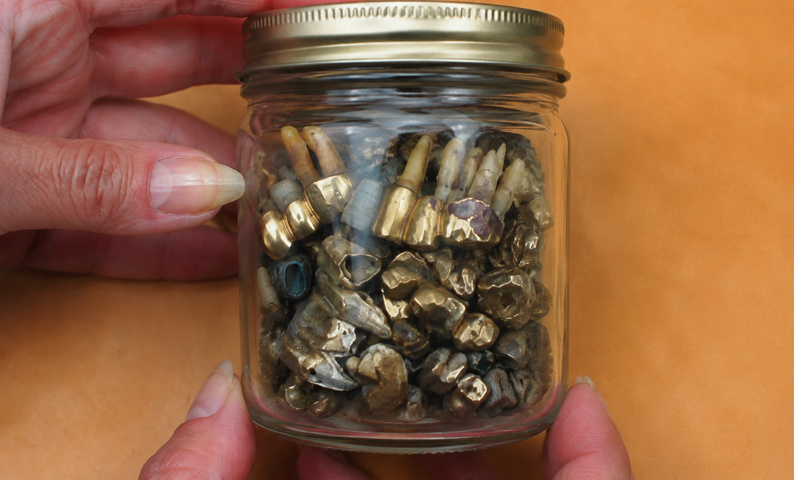 Jar of Gold Teeth From Auschwitz